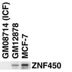 Zinc Finger And BTB Domain-Containing Protein 24 (ZBT24) Antibody