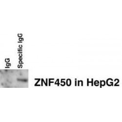 Zinc Finger And BTB Domain-Containing Protein 24 (ZBT24) Antibody