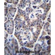 Tumor Protein P53-Inducible Nuclear Protein 1 (TP53INP1) Antibody