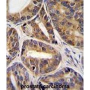 abx026492