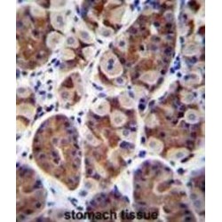 SH2D4B Antibody