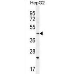 SH2D4B Antibody