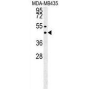 abx026498