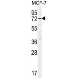 Otopetrin 3 (OTOP3) Antibody