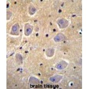 Protein Shisa-6 (SHISA6) Antibody