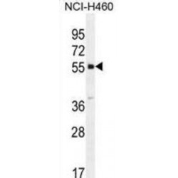 Protein Shisa-6 (SHISA6) Antibody