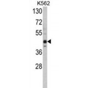 PR/SET Domain-Containing Protein 07 (SET07) Antibody