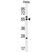 Tubulin Beta-8 Chain-Like Protein (TBB8B) Antibody