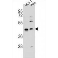 Zinc Finger Protein 384 (ZNF384) Antibody