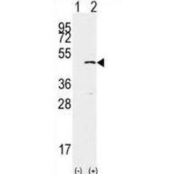 Histone-Lysine N-Methyltransferase SETD7 (SET7) Antibody