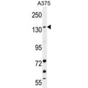 Jumonji Domain-Containing Protein 2B (JMJD2B) Antibody