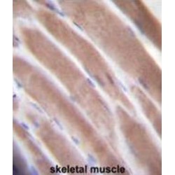 Vascular Endothelial Growth Factor C (VEGFC) Antibody