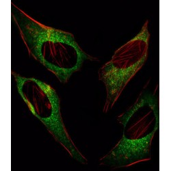 DNA Damage Inducible Transcript 3 (DDIT3) Antibody