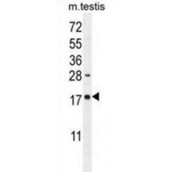 DNA Damage Inducible Transcript 3 (DDIT3) Antibody
