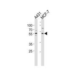 Krueppel-Like Factor 4 (KLF4) Antibody