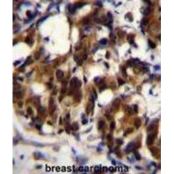 Tumor Necrosis Factor Receptor Type 1-Associated DEATH Domain Protein (TRADD) Antibody