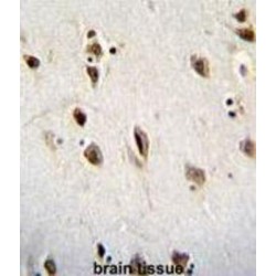 RNA-Binding Protein Musashi Homolog 1 (MSI1) Antibody