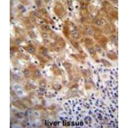 Fumarylacetoacetate Hydrolase (FAH) Antibody