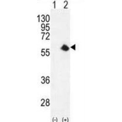 Cyclin-Dependent Kinase 8 (CDK8) Antibody