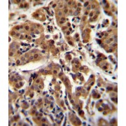 abx026540