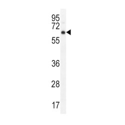 RAC-Alpha Serine/threonine-Protein Kinase (AKT1) Antibody