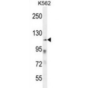 Zinc Finger Protein 99 (ZNF99) Antibody