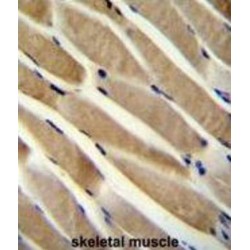 E3 Ubiquitin-Protein Ligase TRIM7 (TRIM7) Antibody