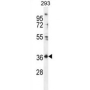 Folate Receptor Delta (FOLR4) Antibody
