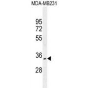 OTU Deubiquitinase 6A (OTUD6A) Antibody