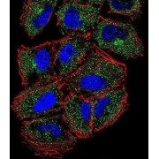 Phospholipase C Like 2 (PLCL2) Antibody