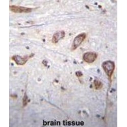 Phospholipase C Like 2 (PLCL2) Antibody