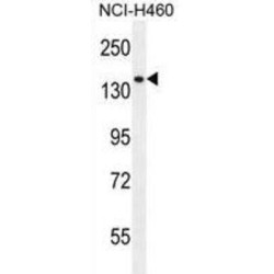 Phospholipase C Like 2 (PLCL2) Antibody