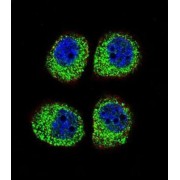 Arrestin Beta 1 (ARRB1) Antibody