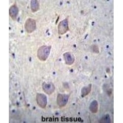 Arrestin Beta 1 (ARRB1) Antibody