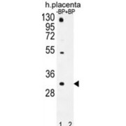 Olfactory Receptor 1D5 (OR1D5) Antibody