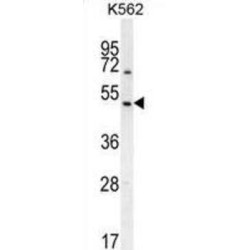 Regulator Of G Protein Signaling 7 (RGS7) Antibody