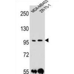 Protocadherin 1 (PCDH1) Antibody