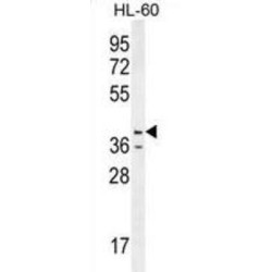 Caspase 12 (CASP12) Antibody