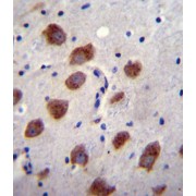 Bone Morphogenetic Protein Receptor 1B (BMPR1B) Antibody