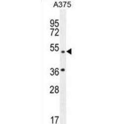 AP-1 Complex Subunit Mu-1 (AP1M1) Antibody