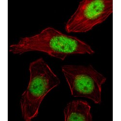 Transcriptional Activator Protein Pur-Beta (PURB) Antibody