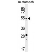 Suppressor of Variegation 4-20 Homolog 2 (SUV4-20H2) Antibody