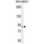 Histone Acetyltransferase KAT2B (PCAF) Antibody