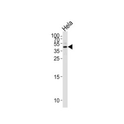 Serpin B5 (SERPINB5) Antibody