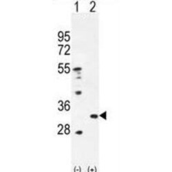 Peroxiredoxin 4 (PRDX4) Antibody