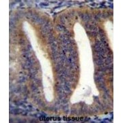 RNA-Binding Protein With Multiple Splicing 2 (RBPMS2) Antibody