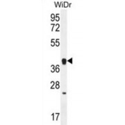 Olfactory Receptor 2T8 (OR2T8) Antibody