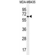 PRAME Family Member 20 (PRAMEF20) Antibody