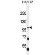 WB analysis of HepG2 cell lysate using COL21A1 antibody. COL21A1 protein detection is shown by the arrow.
