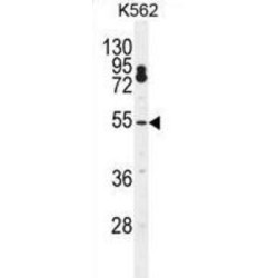 Cleavage And Polyadenylation Specificity Factor Subunit 7 (CPSF7) Antibody